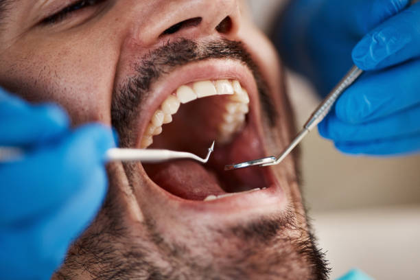 Best Urgent Care for Lost Fillings or Crowns in Morgan, UT